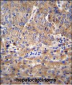 DEF Antibody  (N-term)